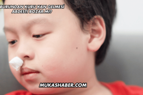 Burundan Kuru Kan Gelmesi Abdesti Bozar mı?