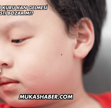 Burundan Kuru Kan Gelmesi Abdesti Bozar mı?