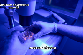 Kök Hücre ile Menisküs Tedavisi