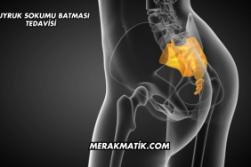 Kuyruk Sokumu Batması Tedavisi
