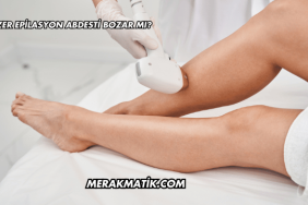 Lazer Epilasyon Abdesti Bozar mı?