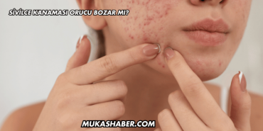 Sivilce Kanaması Orucu Bozar mı?