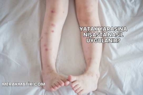 Yatak Yarasına Nişasta Nasıl Uygulanır?