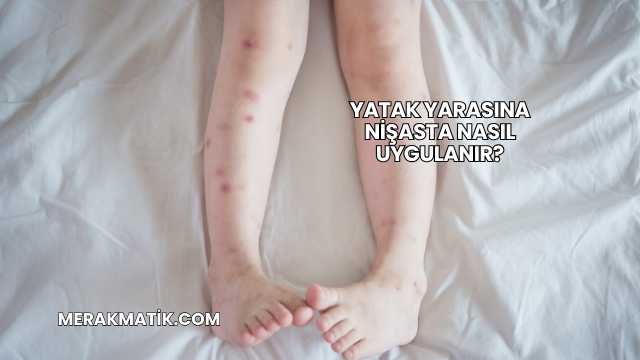 Yatak Yarasına Nişasta Nasıl Uygulanır?